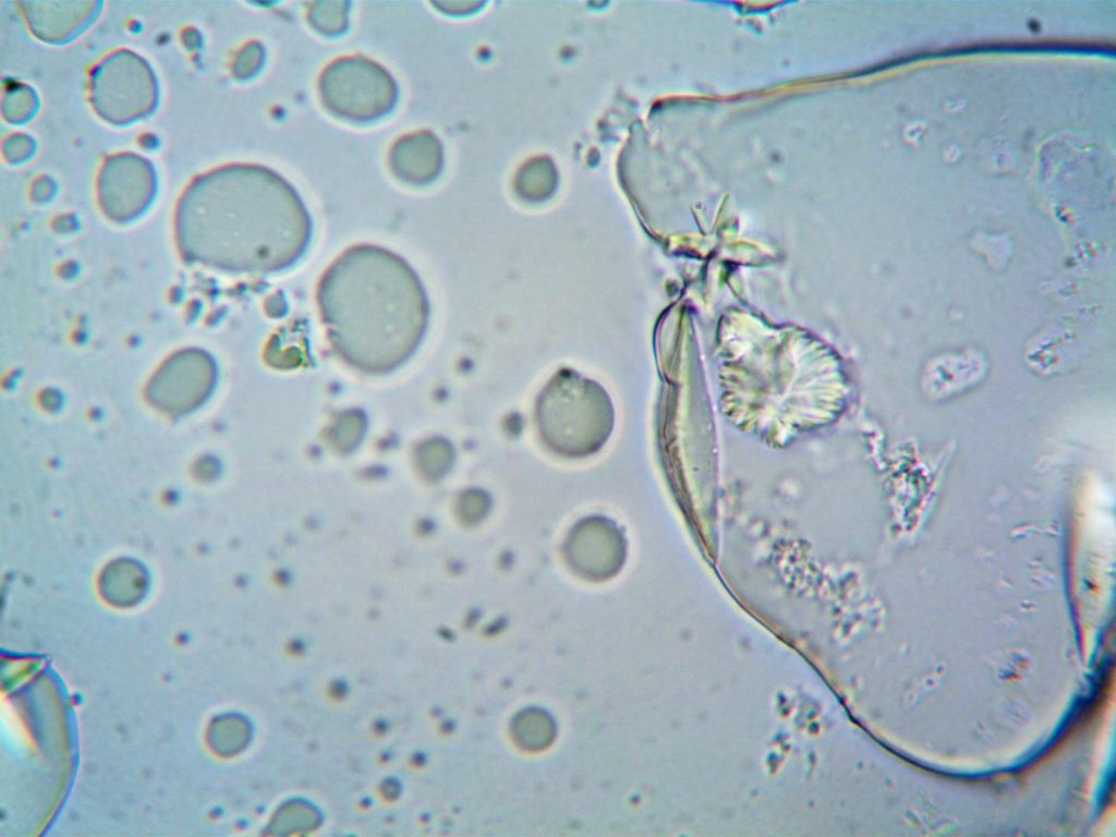 Detailed magnified image illustrating the cellular structure under a microscope.