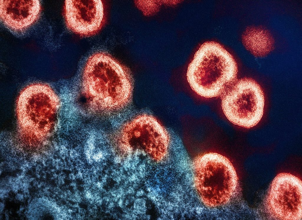 a group of red and black cells on a blue background