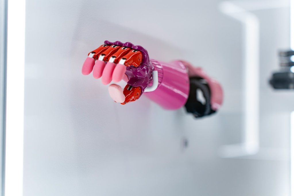 A pink prosthetic hand with a fist.