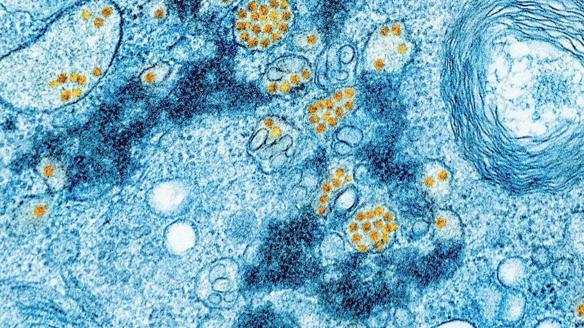 a blue and yellow substance with yellow dots