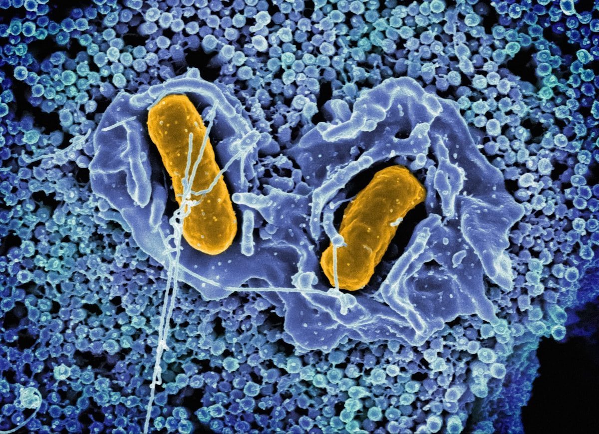 a cell with two yellow cells inside of it