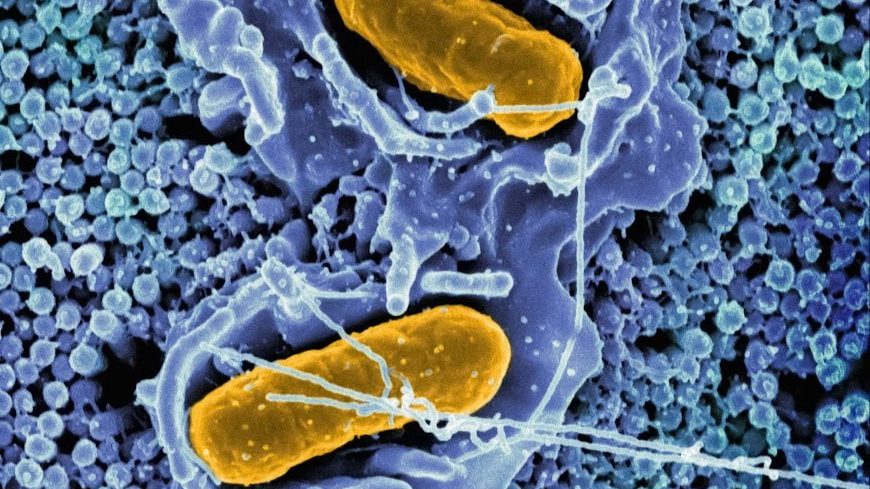 a cell with two yellow cells inside of it