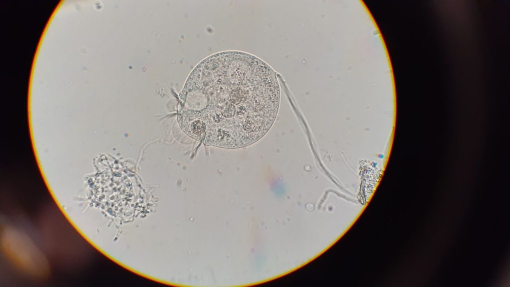 Detailed microscopic image of protozoa in Halifax, showcasing intricate cellular structures.