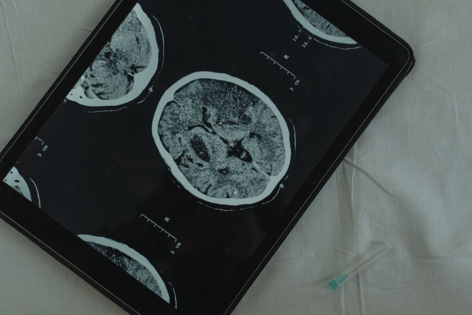 Why Common Toxins Are Secretly Targeting Our Brains