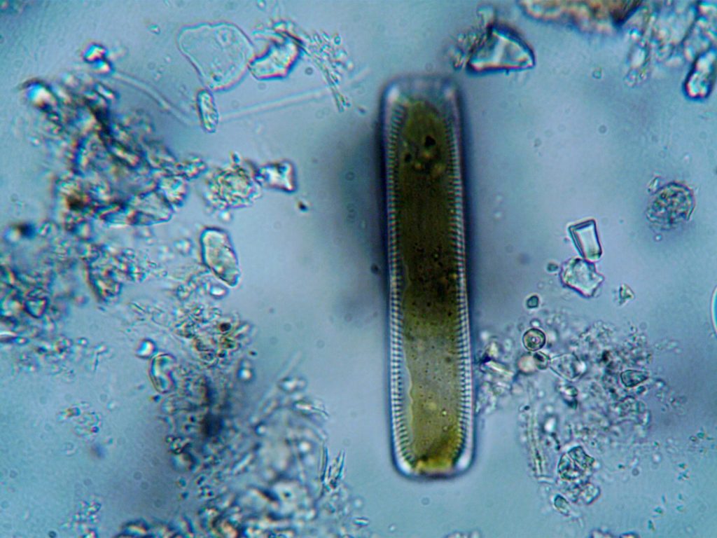 Detailed image of a diatom viewed through a microscope, showcasing cellular structure.