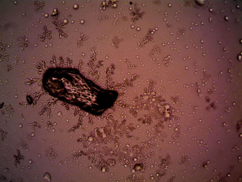 Close-up of bacteria and crystal formations under a microscope, displaying intricate patterns.
