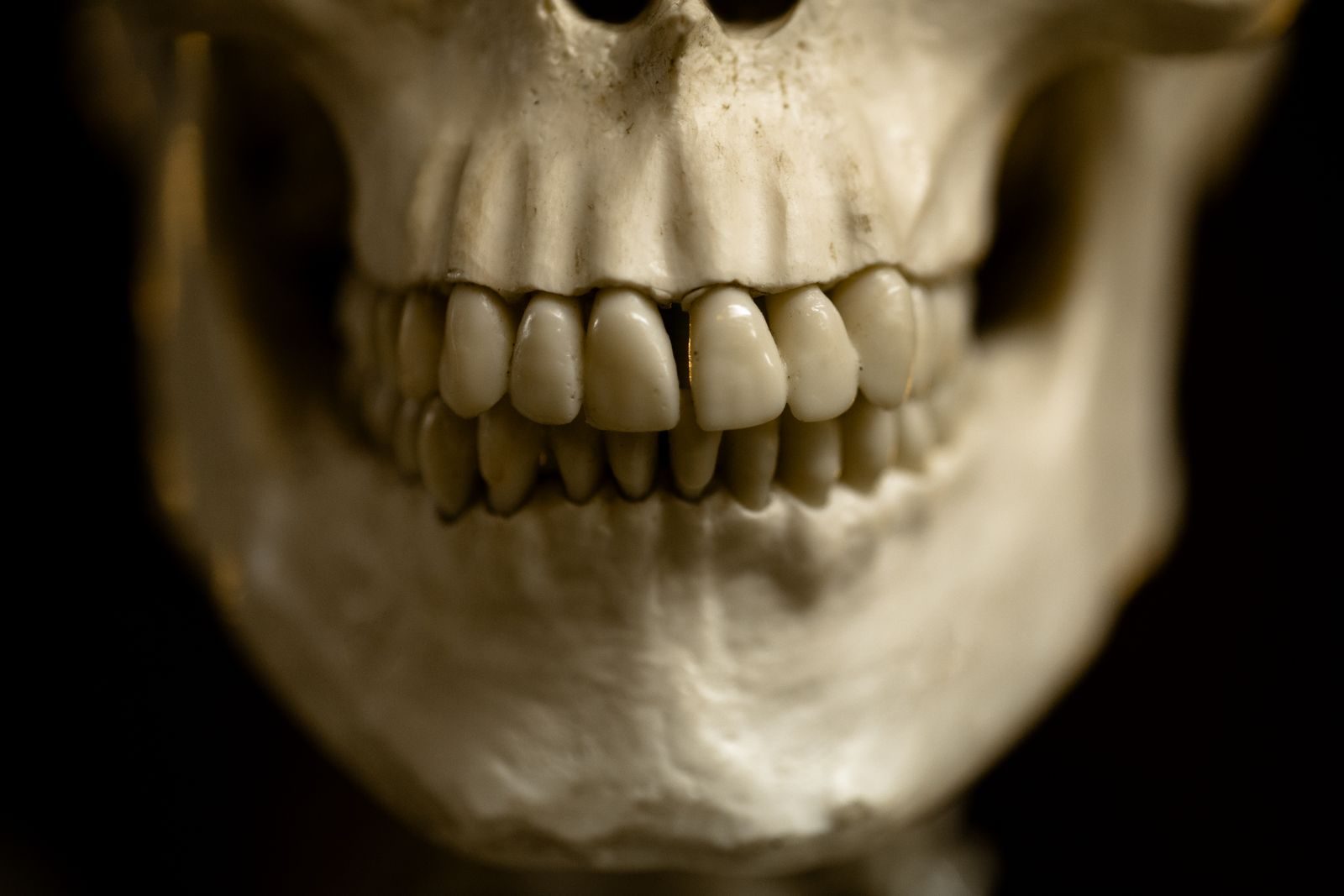Detailed close-up photo of a human skull focusing on teeth.