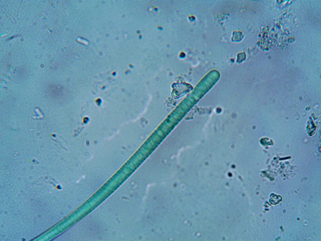 Close-up microscopic image showcasing a cyanobacteria strand, revealing intricate cell structures.