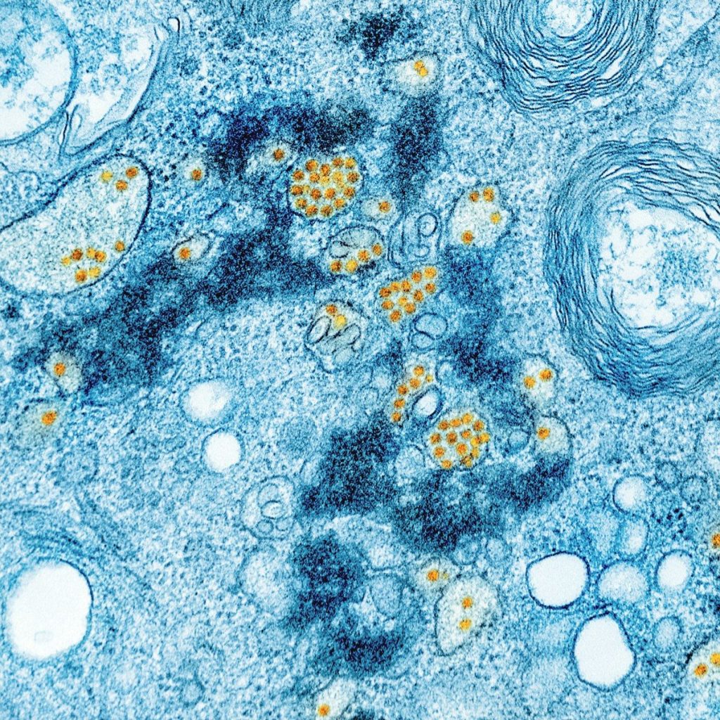 a blue and yellow substance with yellow dots